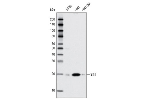  Image 4: Hedgehog Signaling Antibody Sampler Kit