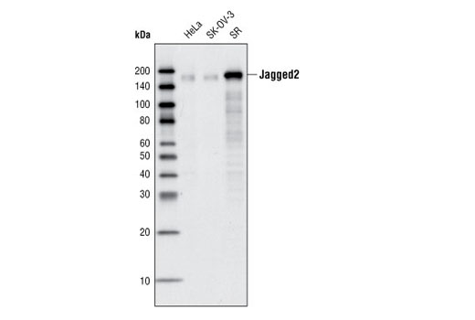  Image 1: Notch Receptor Interaction Antibody Sampler Kit