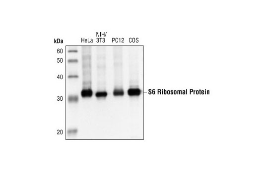 Western Blotting Image 1: S6 Ribosomal Protein (5G10) Rabbit mAb
