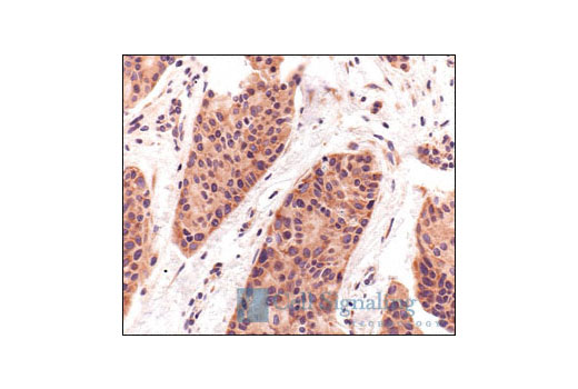 Immunohistochemistry Image 1: S6 Ribosomal Protein (5G10) Rabbit mAb