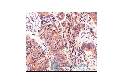 Immunohistochemistry Image 3: S6 Ribosomal Protein (5G10) Rabbit mAb