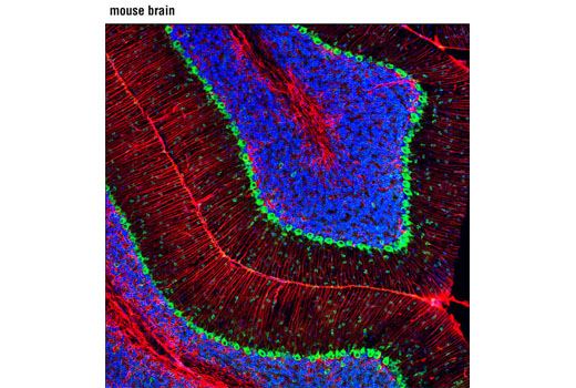 Immunofluorescence Image 1: S6 Ribosomal Protein (5G10) Rabbit mAb