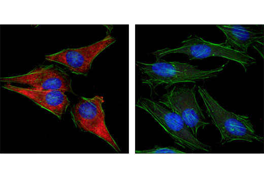  Image 16: PhosphoPlus® S6 Ribosomal Protein (Ser235/Ser236) Antibody Duet