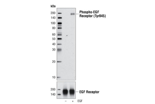 Western Blotting Image 1: Phospho-EGF Receptor (Tyr845) Antibody