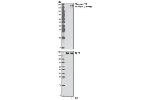 Western Blotting Image 2: EGF Receptor Antibody