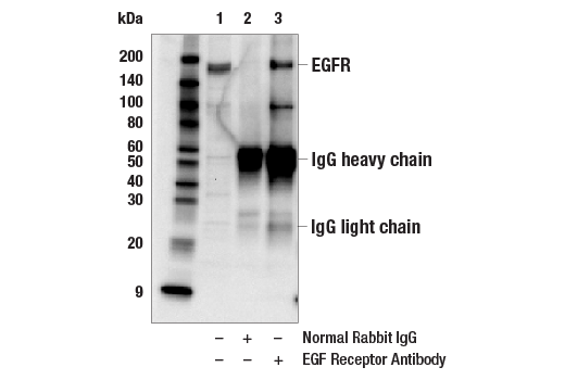 Immunoprecipitation Image 1: EGF Receptor Antibody
