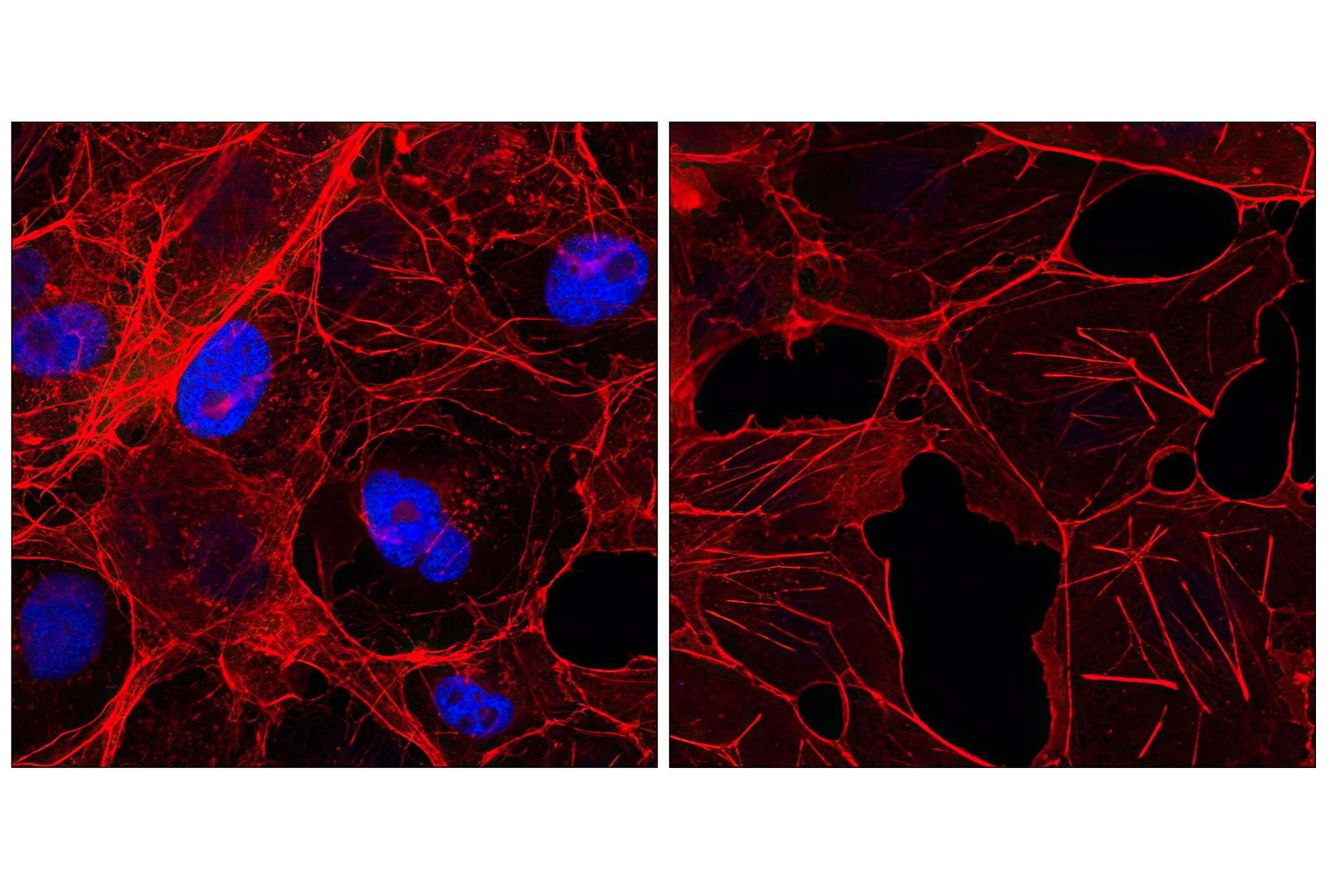 Immunofluorescence Image 1: Myc-Tag (9B11) Mouse mAb (Alexa Fluor® 647 Conjugate)