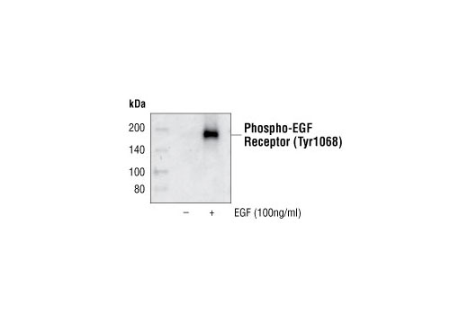 Western Blotting Image 1: Phospho-EGF Receptor (Tyr1068) Antibody