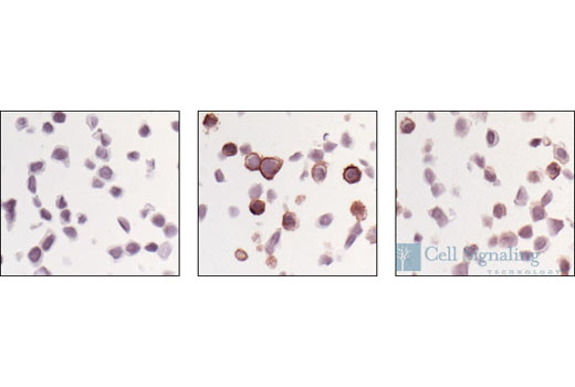 Immunohistochemistry Image 2: Phospho-EGF Receptor (Tyr1068) Antibody