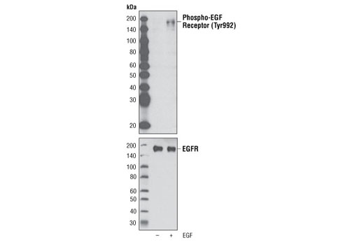 Western Blotting Image 1: Phospho-EGF Receptor (Tyr992) Antibody