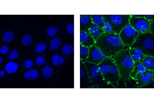 Immunofluorescence Image 1: Phospho-EGF Receptor (Tyr1045) Antibody