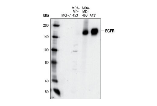 Western Blotting Image 1: EGF Receptor (1F4) Mouse mAb