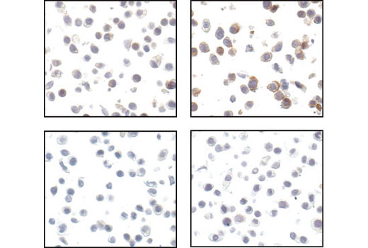 Immunohistochemistry Image 2: Phospho-HER2/ErbB2 (Tyr1221/1222) (6B12) Rabbit mAb