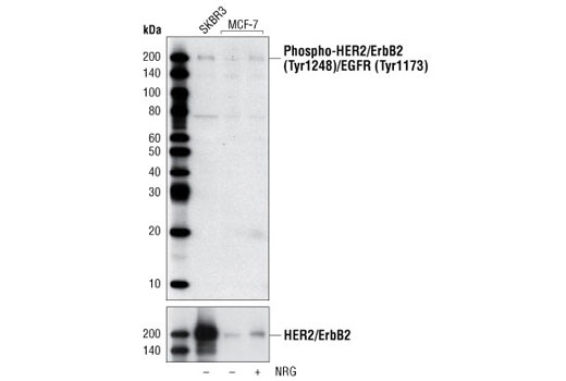 Western Blotting Image 1: Phospho-HER2/ErbB2 (Tyr1248)/EGFR (Tyr1173) Antibody