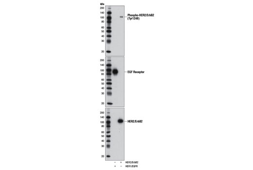 Western Blotting Image 1: Phospho-HER2/ErbB2 (Tyr1248) Antibody