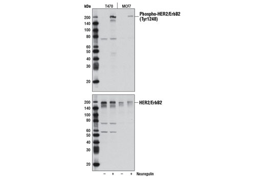 Western Blotting Image 2: Phospho-HER2/ErbB2 (Tyr1248) Antibody