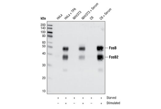  Image 1: Fos Family Antibody Sampler Kit