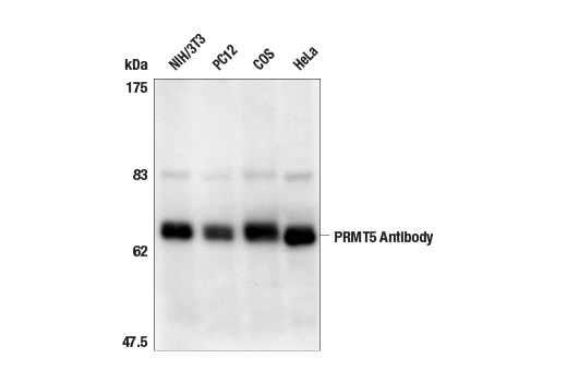 Western Blotting Image 1: PRMT5 Antibody