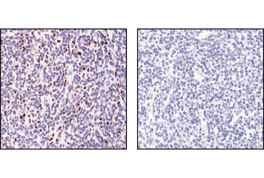 Immunohistochemistry Image 1: PU.1 (9G7) Rabbit mAb (BSA and Azide Free)