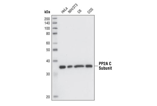  Image 2: PP2A Antibody Sampler Kit
