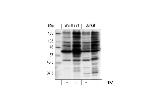 Western Blotting Image 1: Phospho-(Ser) PKC Substrate Antibody