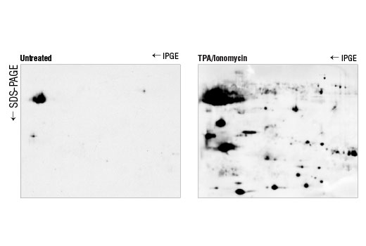 Western Blotting Image 2: Phospho-(Ser) PKC Substrate Antibody