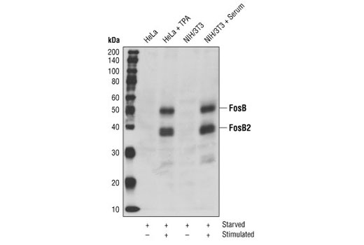 Western Blotting Image 1: FosB Antibody