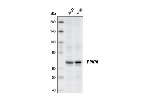 Western Blotting Image 1: RPA70/RPA1 Antibody