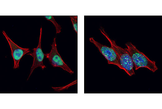 Immunofluorescence Image 1: RPA70/RPA1 Antibody
