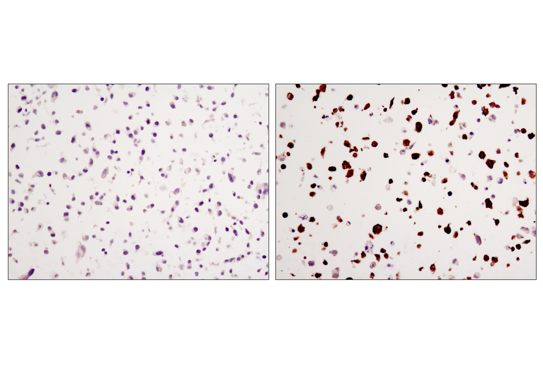 Immunohistochemistry Image 1: Myc-Tag (9B11) Mouse mAb