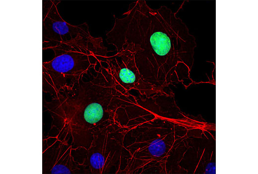 Immunofluorescence Image 1: Myc-Tag (9B11) Mouse mAb
