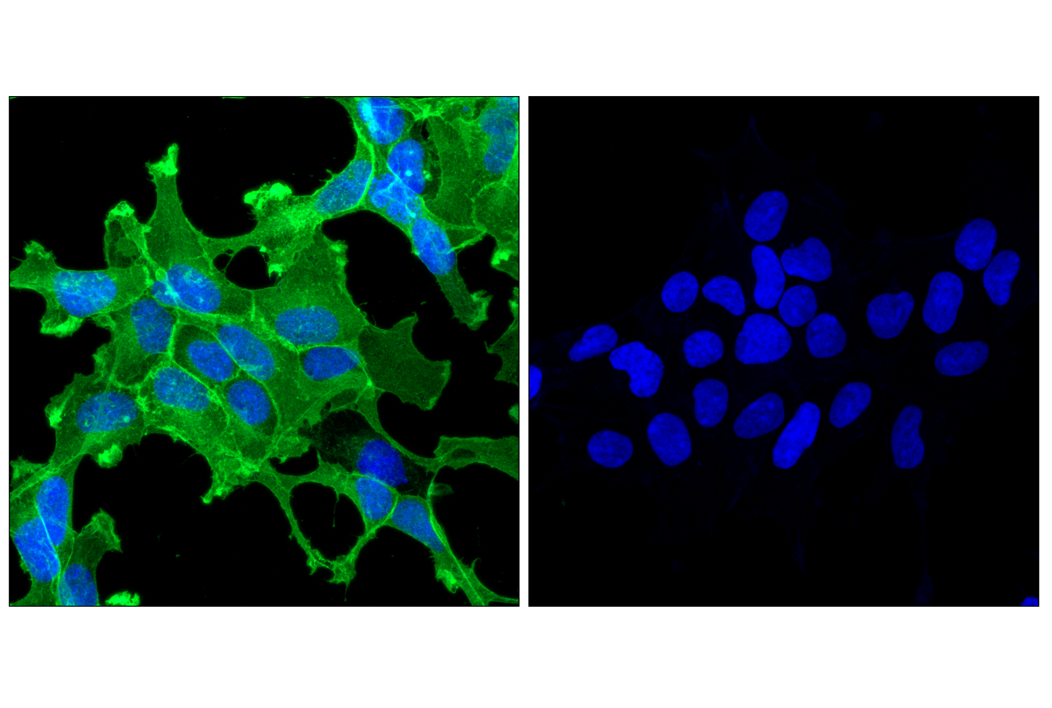 Immunofluorescence Image 1: Myc-Tag (71D10) Rabbit mAb