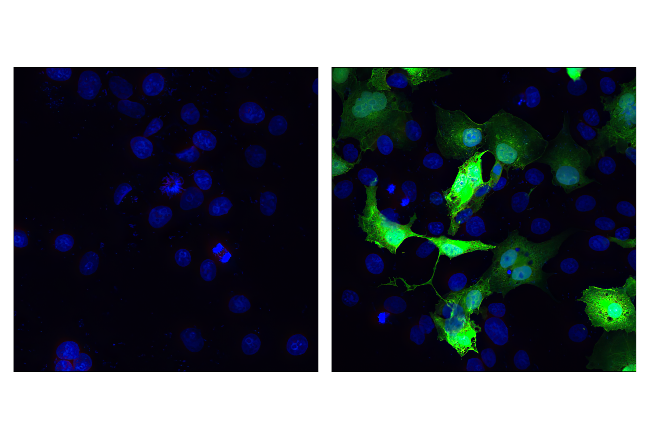 Immunofluorescence Image 1: Myc-Tag (9B11) Mouse mAb (Alexa Fluor® 488 Conjugate)