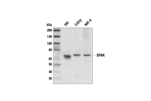 Western Blotting Image 1: SPAK Antibody