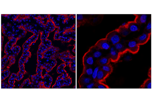 Immunofluorescence Image 1: SPAK Antibody