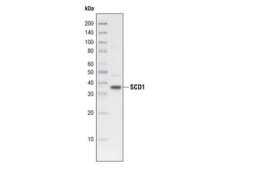 Western Blotting Image 1: SCD1 (R347) Antibody