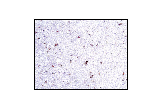 Immunohistochemistry Image 2: Cathepsin D Antibody