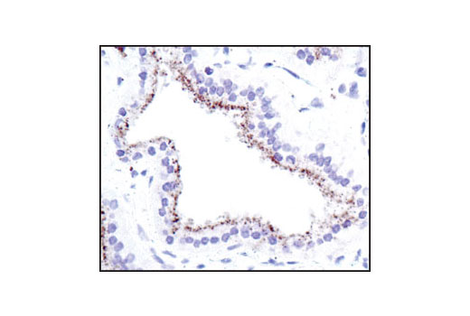 Immunohistochemistry Image 3: Cathepsin D Antibody