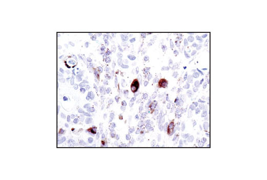 Immunohistochemistry Image 4: Cathepsin D Antibody