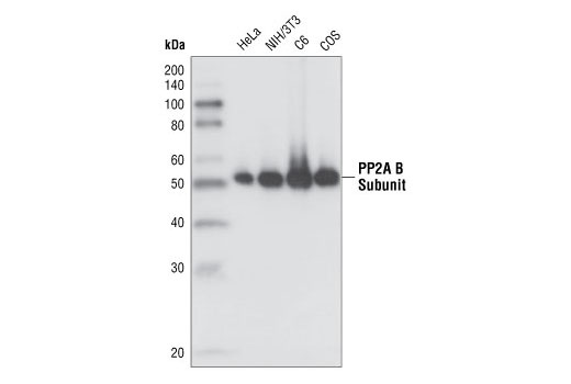  Image 3: PP2A Antibody Sampler Kit