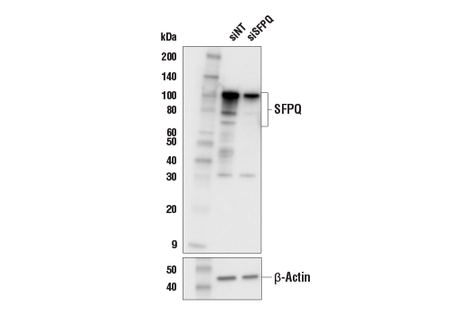 Western Blotting Image 1: SFPQ Antibody