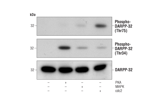 Western Blotting Image 1: DARPP-32 Antibody