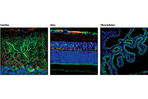 Immunofluorescence Image 1: DARPP-32 (19A3) Rabbit mAb