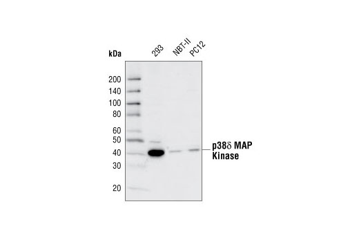  Image 8: p38 MAPK Isoform Activation Antibody Sampler Kit