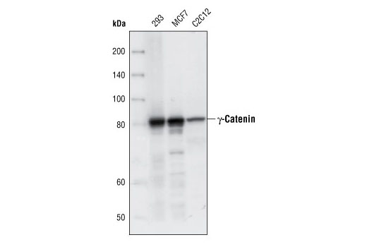 Western Blotting Image 1: γ-Catenin Antibody