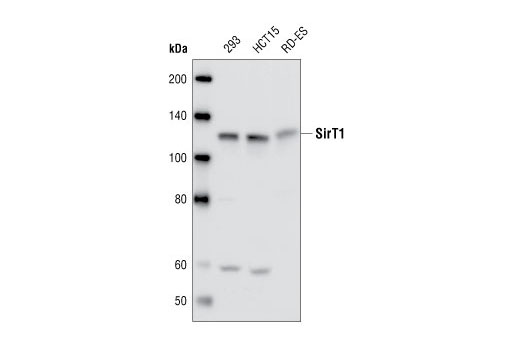 Western Blotting Image 1: SirT1 Antibody