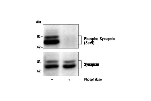 Western Blotting Image 1: Phospho-Synapsin (Ser9) Antibody