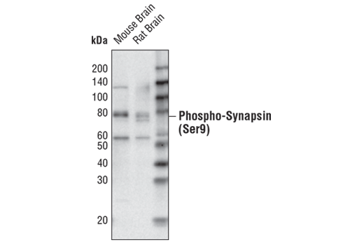 Western Blotting Image 2: Phospho-Synapsin (Ser9) Antibody