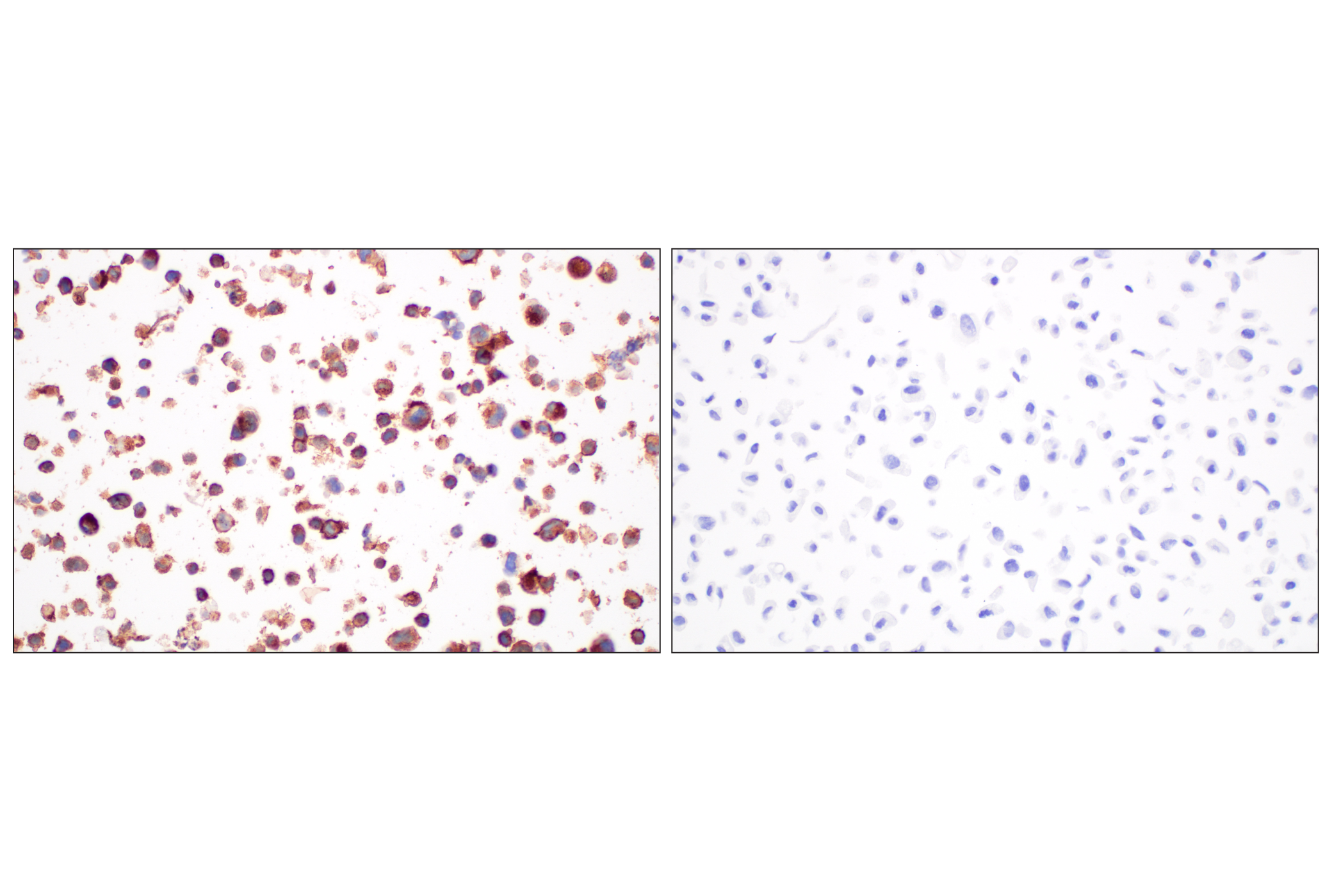Immunohistochemistry Image 8: CD4 (MSVA-004R) Rabbit mAb (BSA and Azide Free)