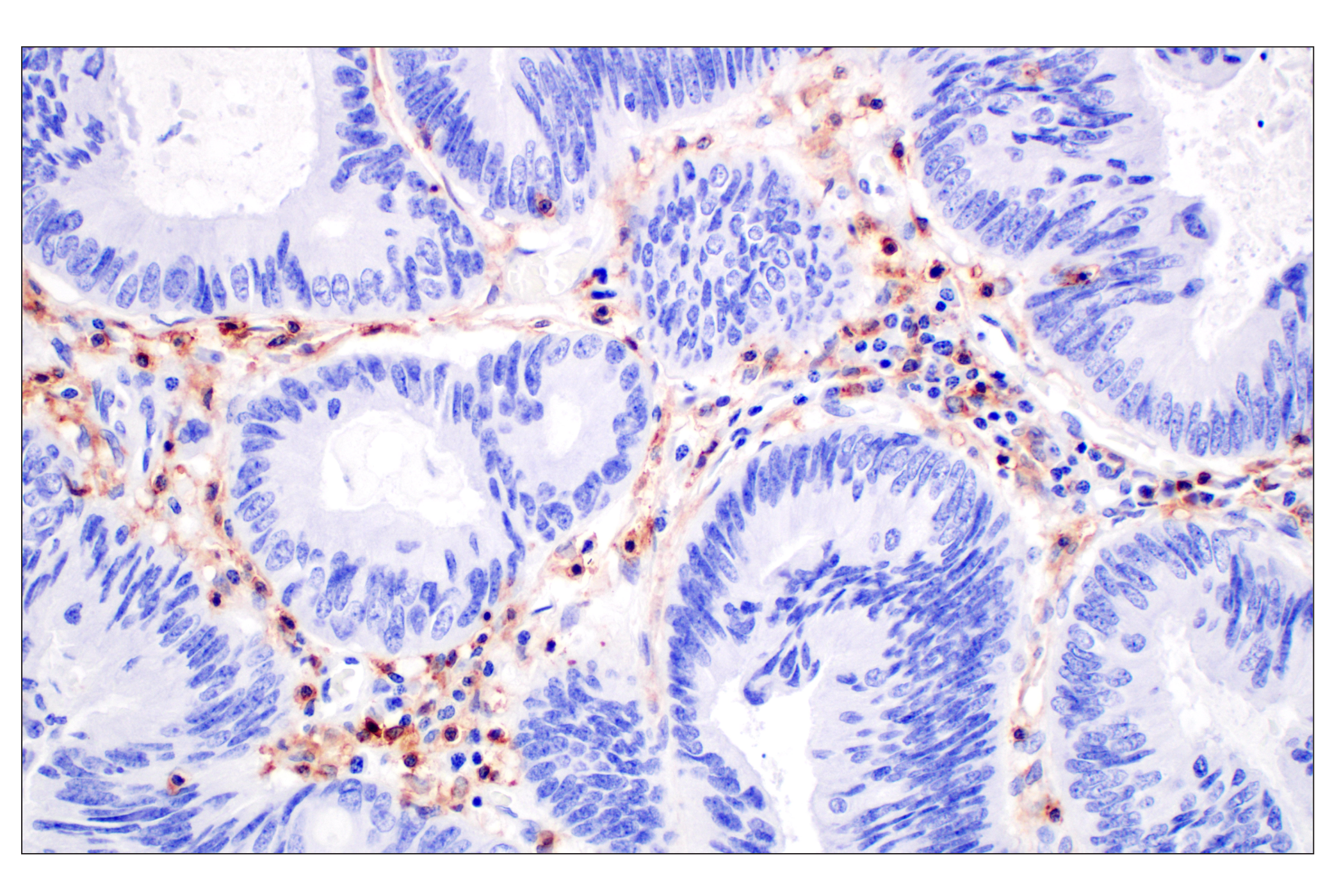 Immunohistochemistry Image 4: CD4 (MSVA-004R) Rabbit mAb (BSA and Azide Free)